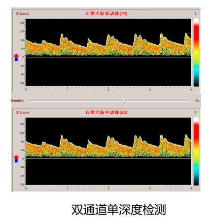 多普勒雙通道單深度圖.jpg